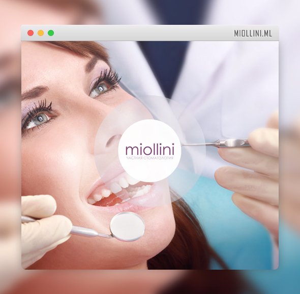 Лендинг стоматологической клиники &#171;Miollini&#187;