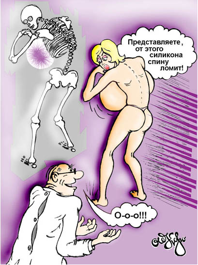Карикатура &quot;силикон&quot;