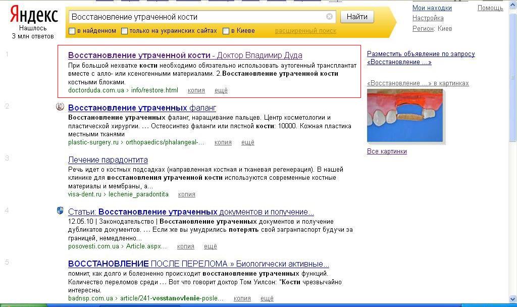 Восстановление утраченной кости, Яндекс
