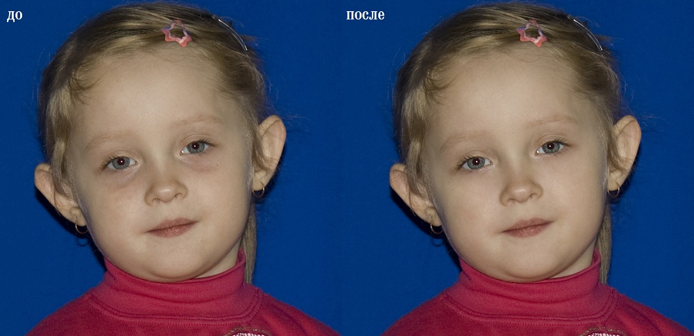 ретуширование портрета ребёнка
